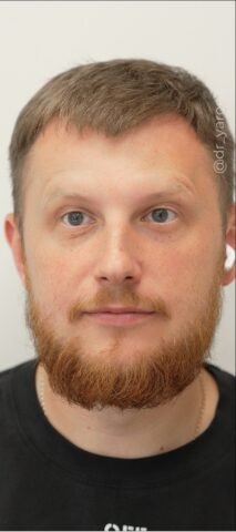 Після